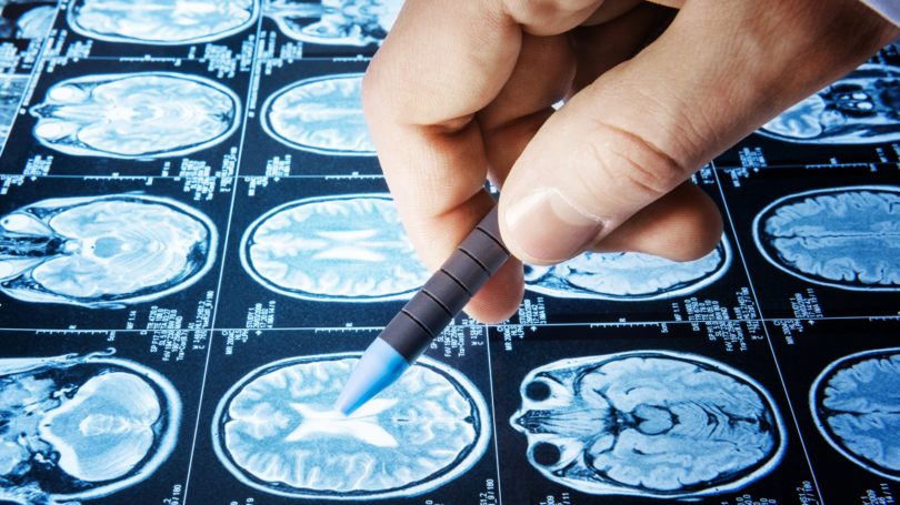 Tomografía computarizada del cerebro del trabajador de diagnóstico por imágenes
