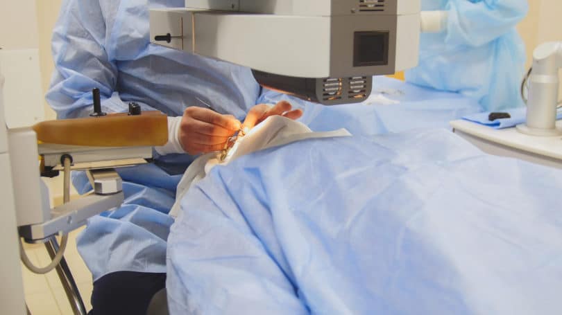 Queratectomía foto refractiva